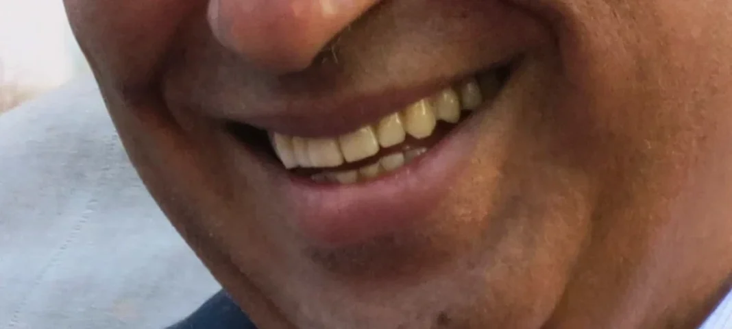 sorrisocosta